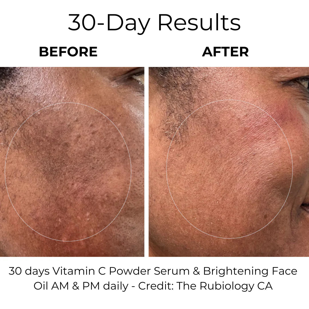 Vitamin C Powder Serum 27g – Brightens & Evens Skin Tone | Ilumina y mejora el tono de la piel